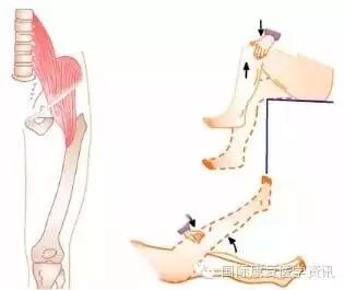 怎么评估病人肌力运动功能检查｜肌力评估_https://www.jmylbn.com_新闻资讯_第24张