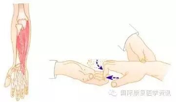 怎么评估病人肌力运动功能检查｜肌力评估_https://www.jmylbn.com_新闻资讯_第20张