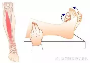 怎么评估病人肌力运动功能检查｜肌力评估_https://www.jmylbn.com_新闻资讯_第28张