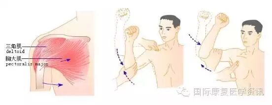 怎么评估病人肌力运动功能检查｜肌力评估_https://www.jmylbn.com_新闻资讯_第11张