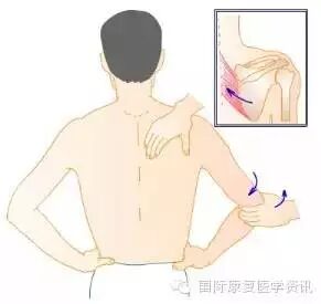 怎么评估病人肌力运动功能检查｜肌力评估_https://www.jmylbn.com_新闻资讯_第8张