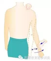 怎么评估病人肌力运动功能检查｜肌力评估_https://www.jmylbn.com_新闻资讯_第9张