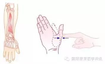 怎么评估病人肌力运动功能检查｜肌力评估_https://www.jmylbn.com_新闻资讯_第18张