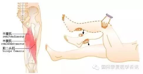 怎么评估病人肌力运动功能检查｜肌力评估_https://www.jmylbn.com_新闻资讯_第27张