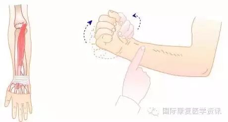 怎么评估病人肌力运动功能检查｜肌力评估_https://www.jmylbn.com_新闻资讯_第21张