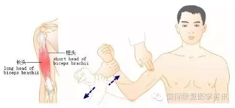 怎么评估病人肌力运动功能检查｜肌力评估_https://www.jmylbn.com_新闻资讯_第15张