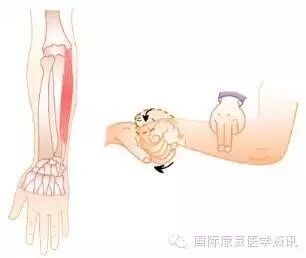 怎么评估病人肌力运动功能检查｜肌力评估_https://www.jmylbn.com_新闻资讯_第22张