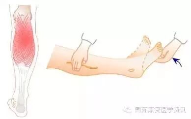 怎么评估病人肌力运动功能检查｜肌力评估_https://www.jmylbn.com_新闻资讯_第31张