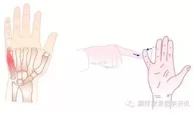 怎么评估病人肌力运动功能检查｜肌力评估_https://www.jmylbn.com_新闻资讯_第23张