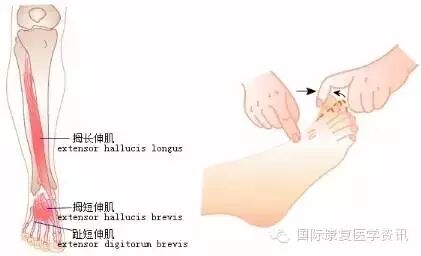 怎么评估病人肌力运动功能检查｜肌力评估_https://www.jmylbn.com_新闻资讯_第29张