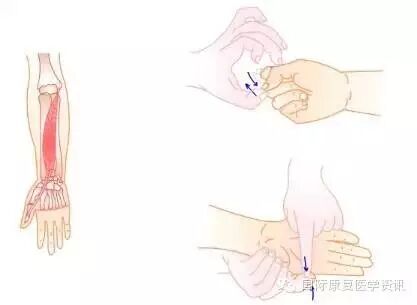 怎么评估病人肌力运动功能检查｜肌力评估_https://www.jmylbn.com_新闻资讯_第19张