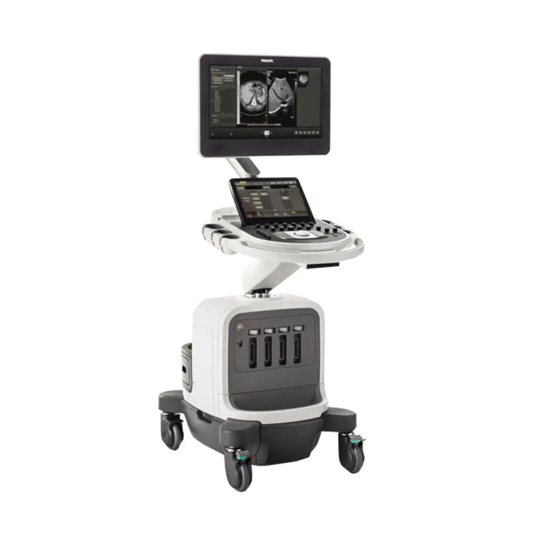 彩超怎么判断故障飞利浦EPIQ7彩超基本原理及故障排查_https://www.jmylbn.com_新闻资讯_第1张