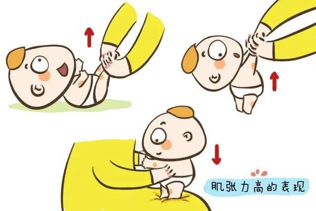 关于孩子“肌张力高”的那些事儿