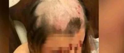 给妻子剃光头，是万万不可取的私刑！