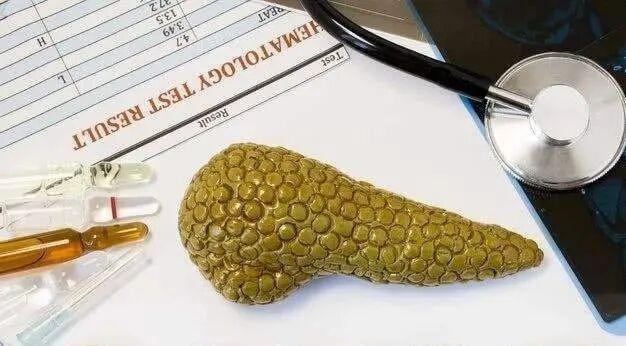 被称作癌中之王的胰腺癌，早期这4个迹象，很难发现