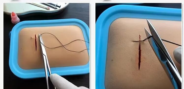 缝合针怎么选规格产品｜医用缝合针_https://www.jmylbn.com_新闻资讯_第7张