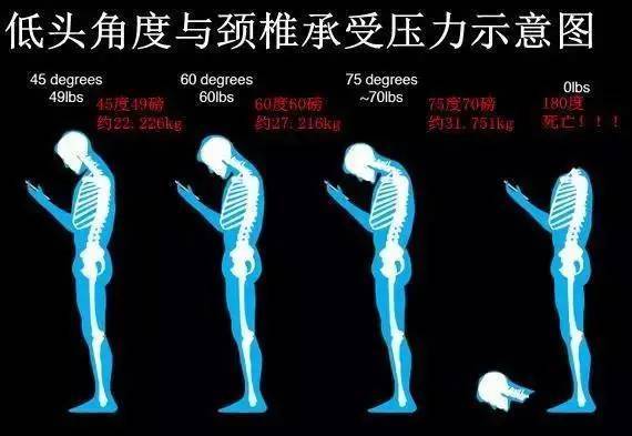 低頭玩手機，身體各器官的變化讓人吃驚！最後一個很嚇人 科技 第3張