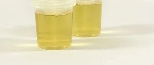 尿常规，人人体检都能用得上的50条小常识，值得收藏！