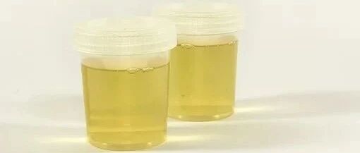 关于尿蛋白，实用的80条常识，值得肾友们收藏！