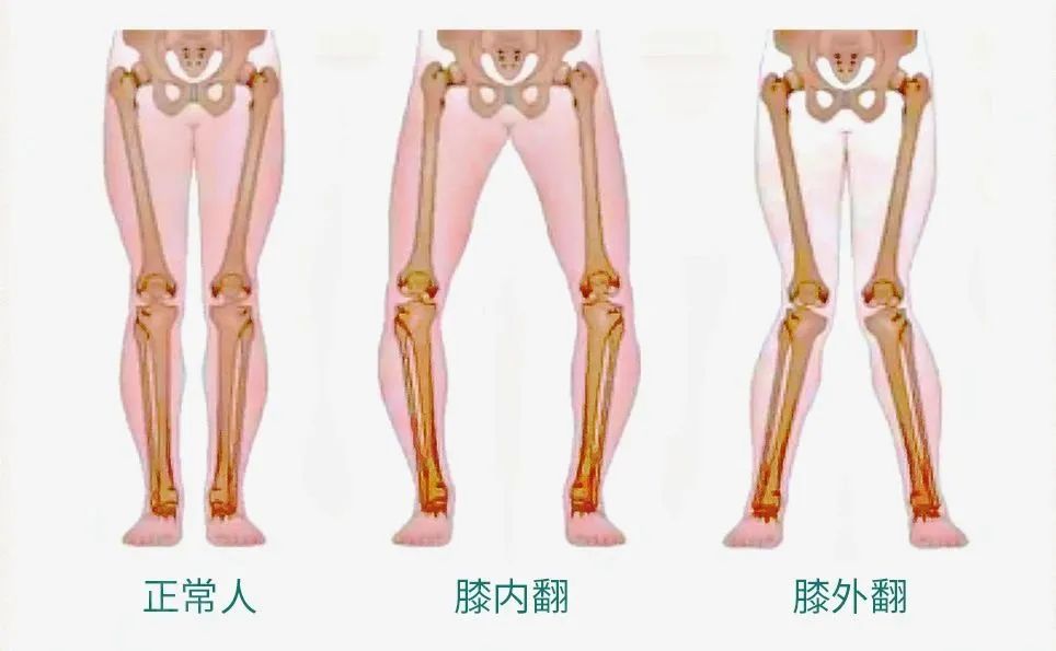 應徵青年曆年徵兵體檢淘汰率最高的15個問題集錦請轉發收藏