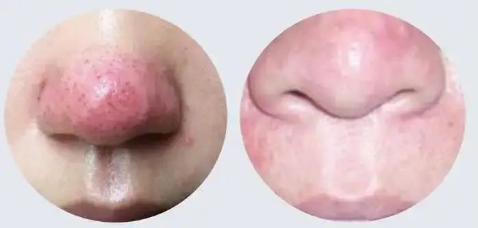红红的小丑鼻子我该怎么办？