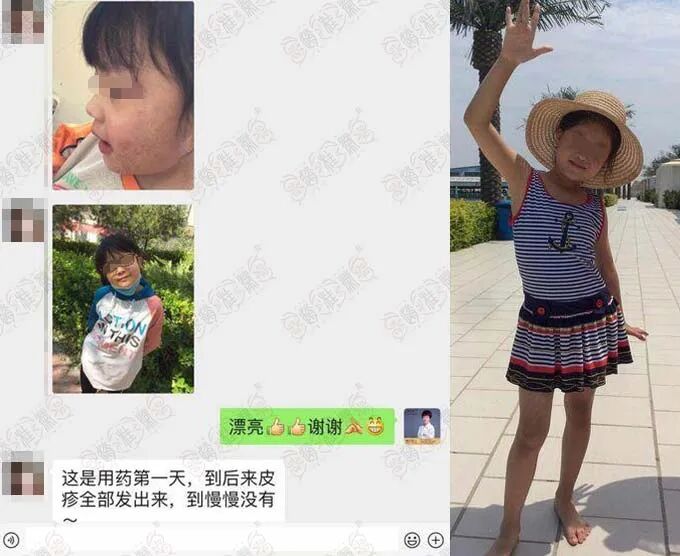 医用冷敷凝胶怎么用械字号“儿童产品”被曝违禁添加氯倍他索丙酸酯（激素）！看看你家娃用没用！_https://www.jmylbn.com_新闻资讯_第4张