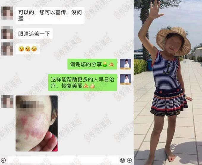 医用冷敷凝胶怎么用械字号“儿童产品”被曝违禁添加氯倍他索丙酸酯（激素）！看看你家娃用没用！_https://www.jmylbn.com_新闻资讯_第5张