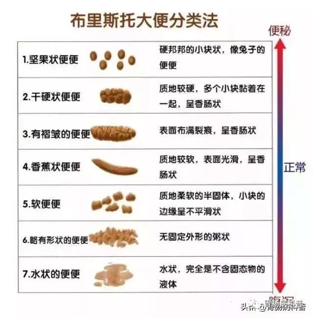 大家可以根据以下现象来辨别自己的大便是否正常:正常的大便应该是