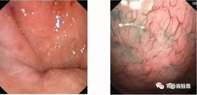 哪些属于硬式内镜从吞剑到吞胶囊——胃镜技术的逆天发展史_https://www.jmylbn.com_新闻资讯_第14张