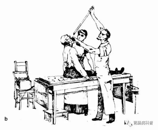 哪些属于硬式内镜从吞剑到吞胶囊——胃镜技术的逆天发展史_https://www.jmylbn.com_新闻资讯_第4张