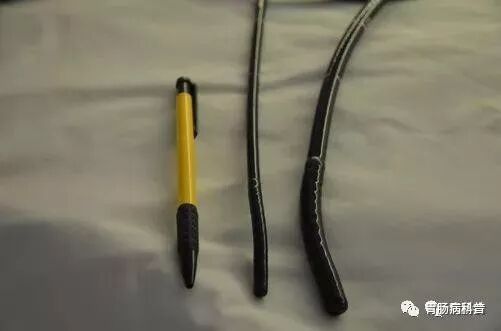 哪些属于硬式内镜从吞剑到吞胶囊——胃镜技术的逆天发展史_https://www.jmylbn.com_新闻资讯_第15张