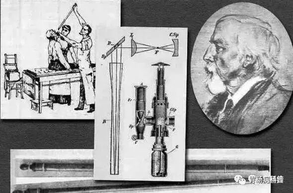 哪些属于硬式内镜从吞剑到吞胶囊——胃镜技术的逆天发展史_https://www.jmylbn.com_新闻资讯_第5张