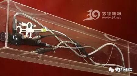 哪些属于硬式内镜从吞剑到吞胶囊——胃镜技术的逆天发展史_https://www.jmylbn.com_新闻资讯_第10张