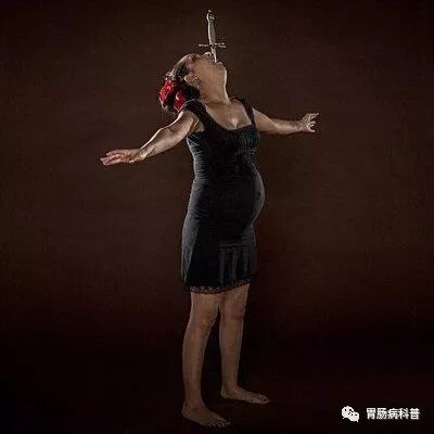 哪些属于硬式内镜从吞剑到吞胶囊——胃镜技术的逆天发展史_https://www.jmylbn.com_新闻资讯_第2张