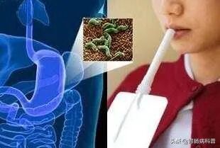 怎么得卡式幽门螺杆菌幽门螺杆菌没那么可怕，我来教你怎么查、怎么防、怎么治_https://www.jmylbn.com_新闻资讯_第4张