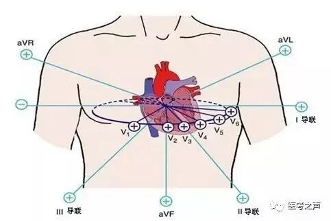 心电监护怎么看图图文并茂最全心电图，值得转发收藏_https://www.jmylbn.com_新闻资讯_第63张