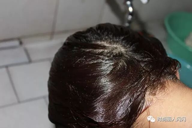 头发两天不洗就出油？洗头时加个“小药片”，清爽不油腻还能黑发
