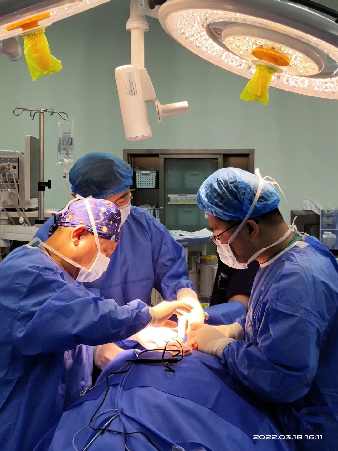 微波针是什么基层动态 ｜ 以“针”代“刀”  微波消融 精准治疗 —— 市第一医院采用新技术为患者带福音_https://www.jmylbn.com_新闻资讯_第5张