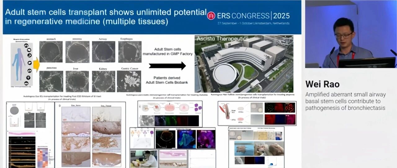 饶威团队成体干细胞单克隆技术成果重磅亮相ERS 2025