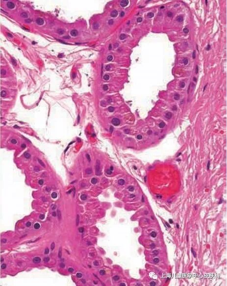 臭汗症（腋臭、脚臭）怎么办？