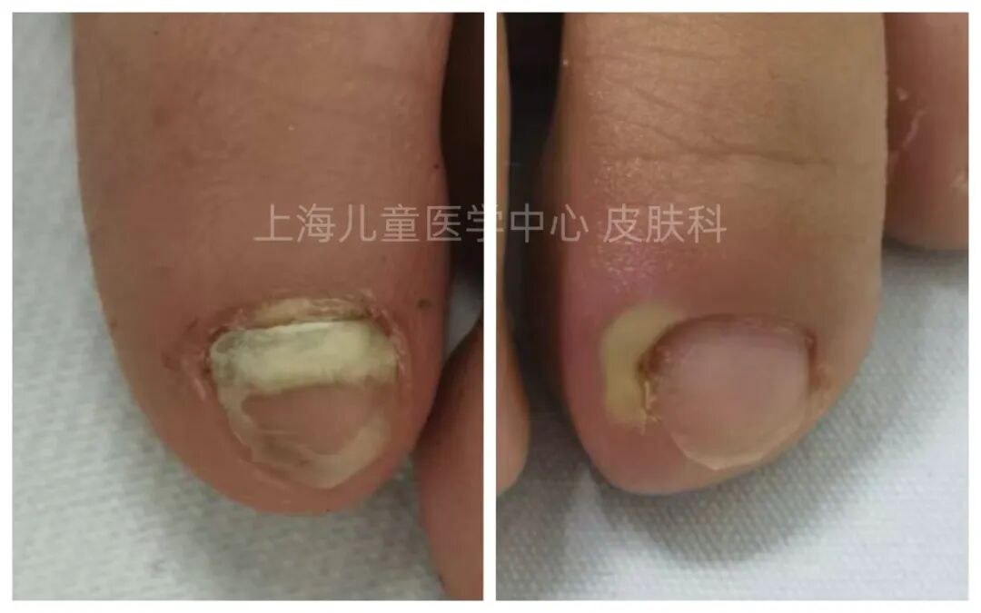 (Imag from Chinese network) 