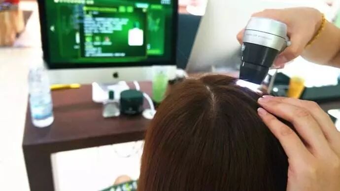 头皮检测，你不得不知道的小知识！