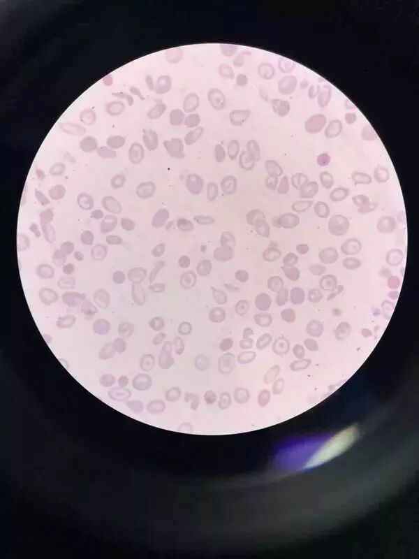 rbc直方图怎么看血常规散点图带给我们的深刻启示！_https://www.jmylbn.com_新闻资讯_第6张