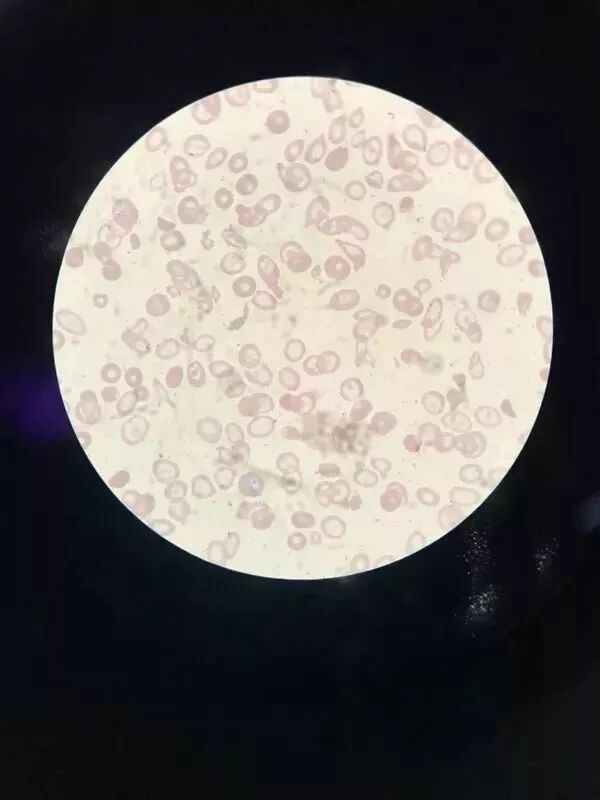 rbc直方图怎么看血常规散点图带给我们的深刻启示！_https://www.jmylbn.com_新闻资讯_第7张