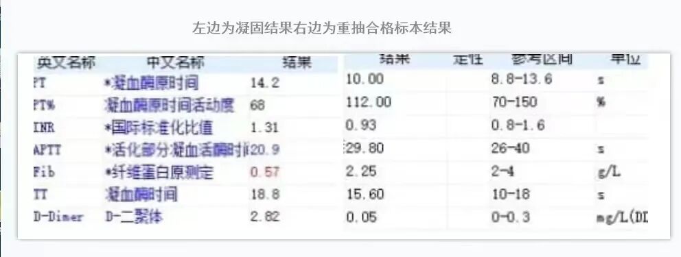 血凝是检查什么的标本凝固对血凝实验的影响_https://www.jmylbn.com_新闻资讯_第4张