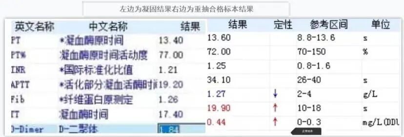 血凝是检查什么的标本凝固对血凝实验的影响_https://www.jmylbn.com_新闻资讯_第1张