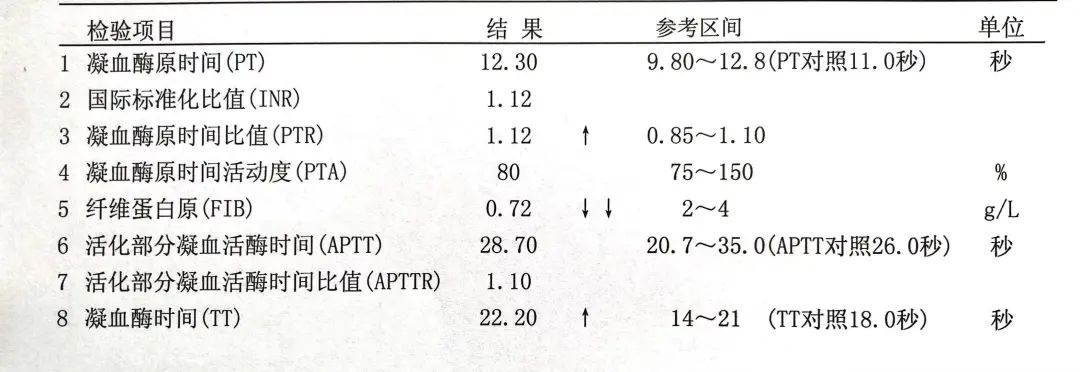 不尋常的低纖維蛋白原血癥