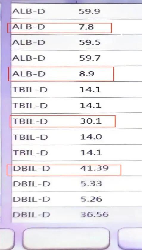 生化设备有哪些问题收藏再看！检验科生化发光流水线的一些『不常见』问题分析_https://www.jmylbn.com_新闻资讯_第5张