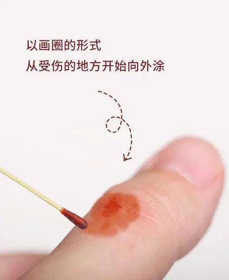 人工敷料怎么照顾伤口【健康科普】伤口护理技巧_https://www.jmylbn.com_新闻资讯_第6张