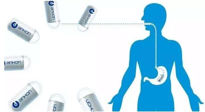 什么是260胃镜胶囊胃镜检查中发现： 胃癌发病率远超想象，50岁以上是重灾区_https://www.jmylbn.com_新闻资讯_第6张